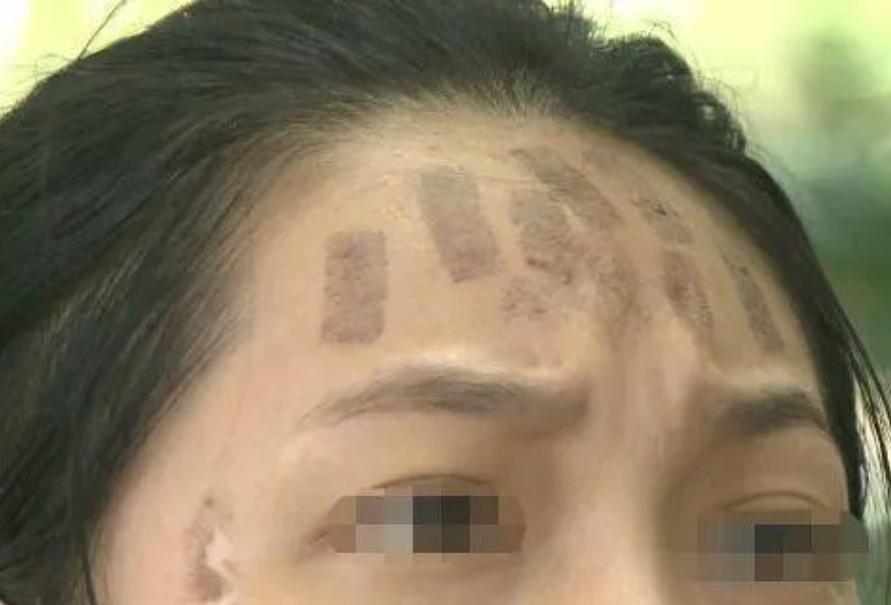 成都光子嫩膚價(jià)格，科技重塑肌膚之美